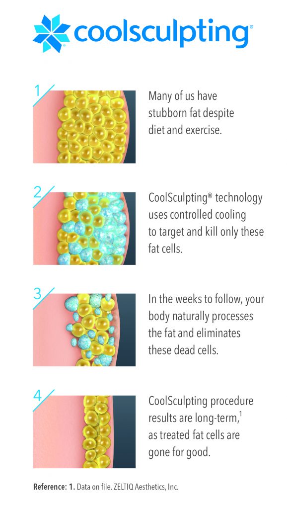 7-Illustration-how-coolsculpting-works-Vert-Medium